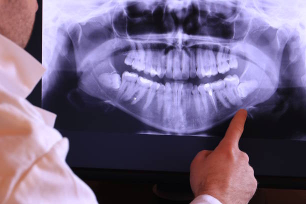 Best Urgent Tooth Repair  in Sayre, OK